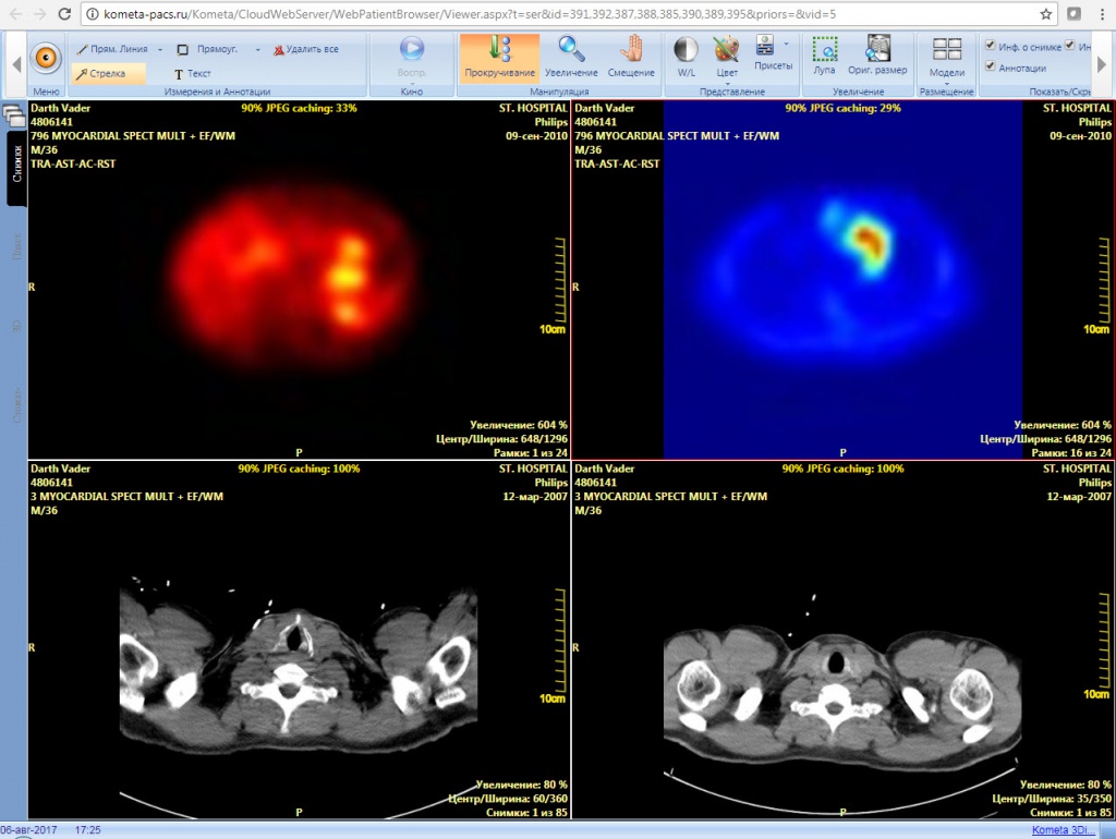 Cardiac_NM_CT_Blue_Red.jpg