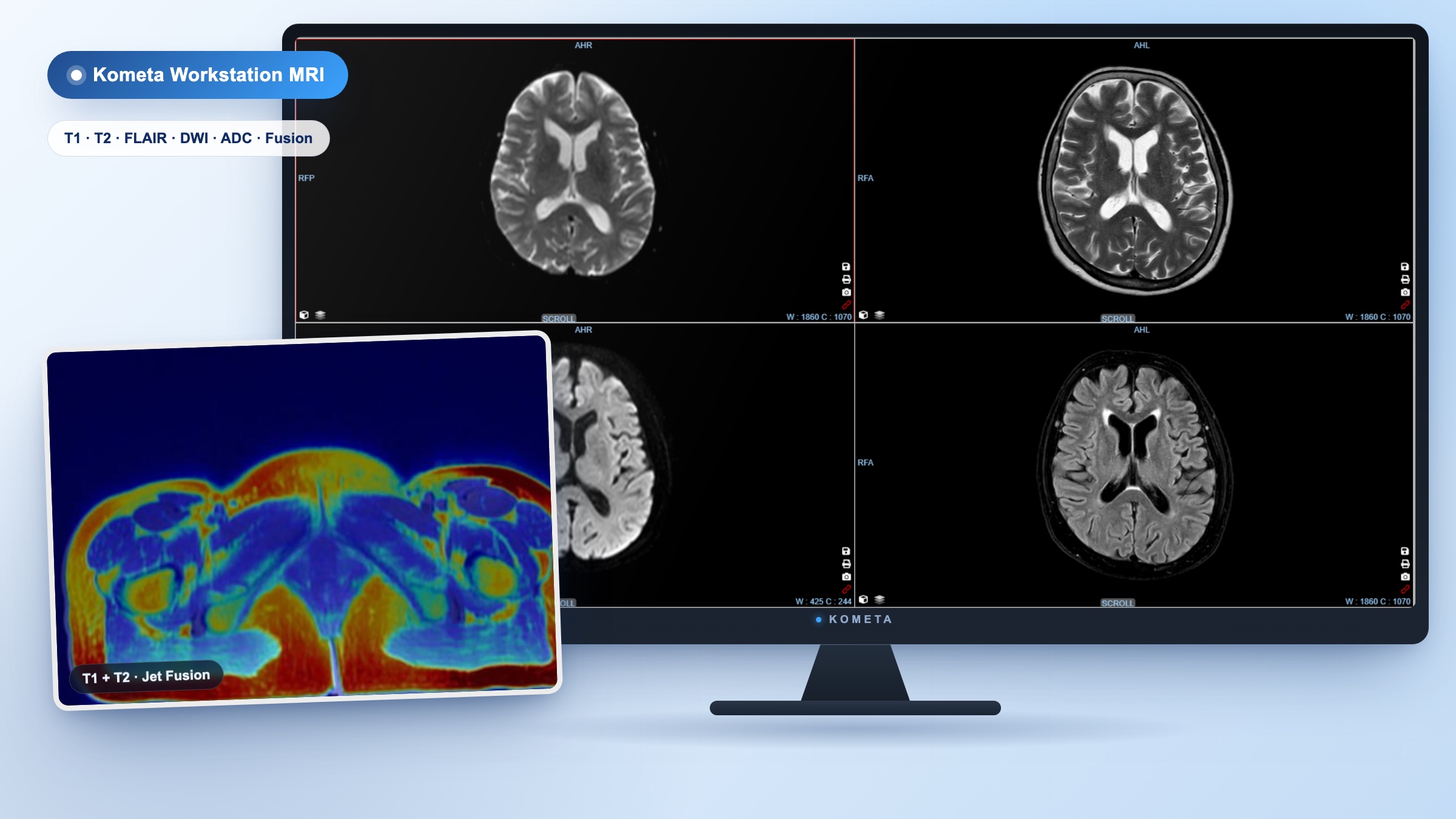 Kometa Workstation MRI Kometa Workstation MRI